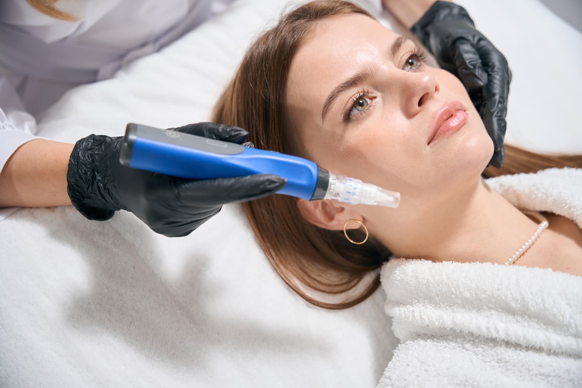 Microneedling mit SkinPen: Behandlung im Behandlungsraum von Beauty Artistry Villingen